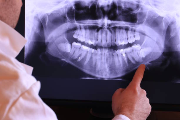 Best Emergency Cosmetic Dentistry in Saratoga Springs, NY