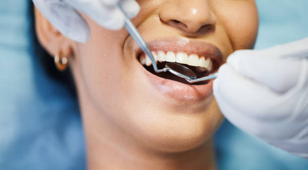 Best Pediatric Emergency Dentist in Saratoga Springs, NY